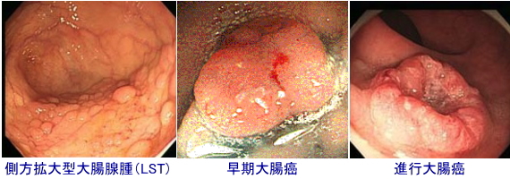 colon_case